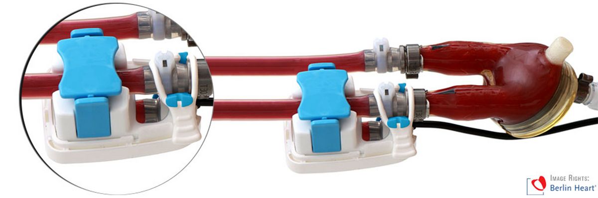 Customized SONOFLOW Clamp-on Sensor on Excor System by Berlin Heart GmbH